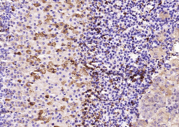 StAR Rabbit Polyclonal Antibody