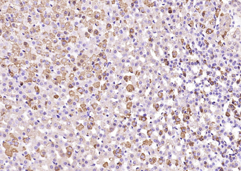 StAR Rabbit Polyclonal Antibody