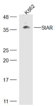 StAR Rabbit Polyclonal Antibody