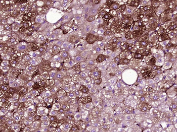 JAK1 Mouse Monoclonal Antibody