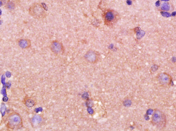 MMP2 Mouse Monoclonal Antibody