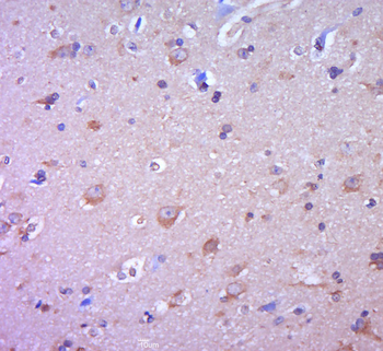 SLC22A17 Rabbit Polyclonal Antibody