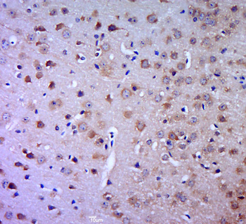 SLC22A17 Rabbit Polyclonal Antibody