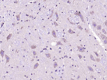 SLC22A17 Rabbit Polyclonal Antibody