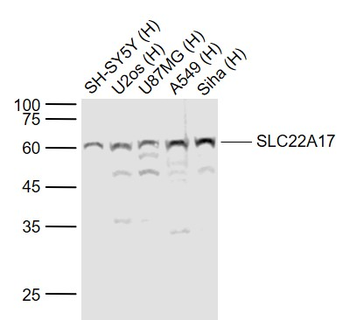 SLC22A17 Rabbit Polyclonal Antibody