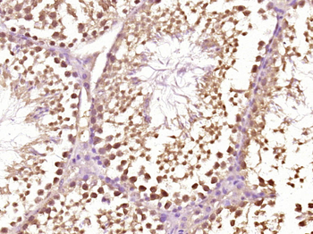 Phospho-beta Catenin (Ser33) Rabbit Polyclonal Antibody