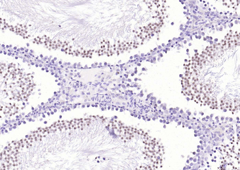 HDAC9 Rabbit Polyclonal Antibody