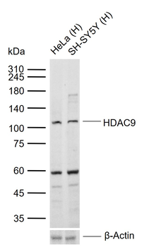 HDAC9 Rabbit Polyclonal Antibody