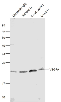 VEGFA Rabbit Polyclonal Antibody