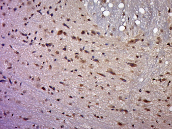 SIP1 Rabbit Polyclonal Antibody