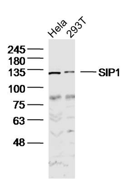 SIP1 Rabbit Polyclonal Antibody
