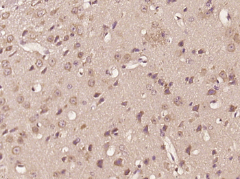 Oligophrenin 1 Rabbit Polyclonal Antibody