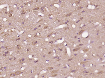 Oligophrenin 1 Rabbit Polyclonal Antibody