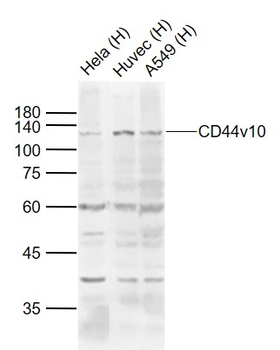 CD44v10 Rabbit Polyclonal Antibody