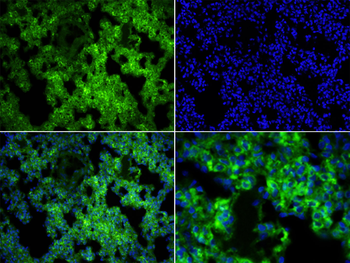 MARCO Rabbit Polyclonal Antibody