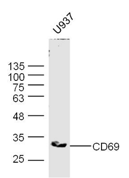 CD69 Rabbit Polyclonal Antibody