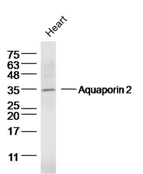 AQP2 Rabbit Polyclonal Antibody