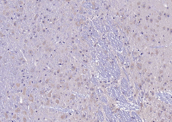 TRPV1 Rabbit Polyclonal Antibody
