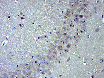 TRPV1 Rabbit Polyclonal Antibody