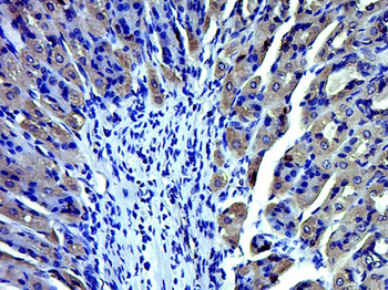 TRPV1 Rabbit Polyclonal Antibody