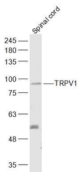 TRPV1 Rabbit Polyclonal Antibody