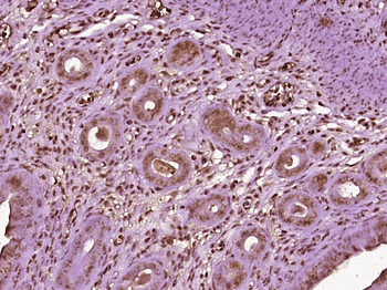 Progesterone Receptor Rabbit Polyclonal Antibody