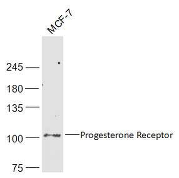 Progesterone Receptor Rabbit Polyclonal Antibody