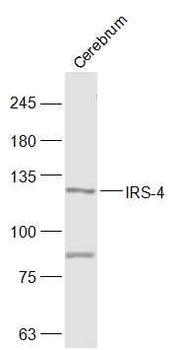IRS-4 Rabbit Polyclonal Antibody