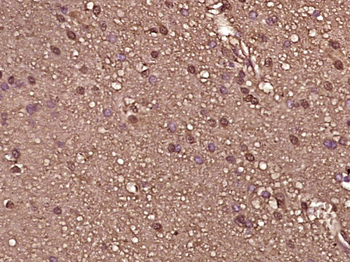 RPS6KB1 Mouse Monoclonal Antibody