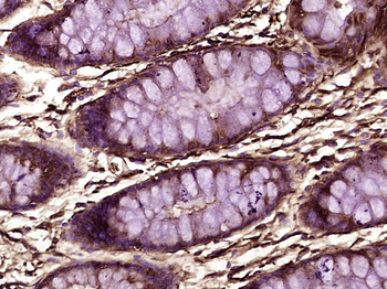 RPS6KB1 Mouse Monoclonal Antibody