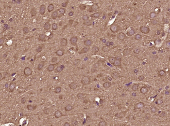 RPS6KB1 Mouse Monoclonal Antibody