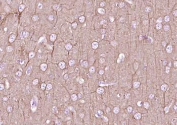 Beta I Tubulin Mouse Monoclonal Antibody (Loading Control)