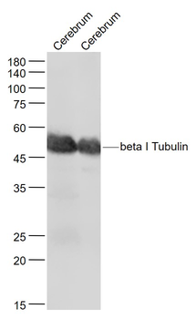 Beta I Tubulin Mouse Monoclonal Antibody (Loading Control)