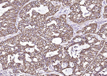 Cytokeratin 19 Mouse Monoclonal Antibody