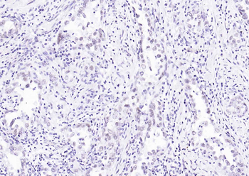HP1 alpha Mouse Monoclonal Antibody