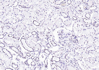 HP1 alpha Mouse Monoclonal Antibody