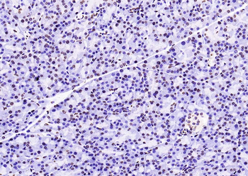 Histone H3 (di methyl K79) Mouse Monoclonal Antibody