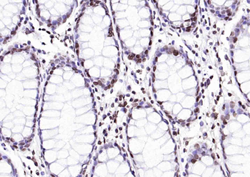 Histone H3 (di methyl K79) Mouse Monoclonal Antibody