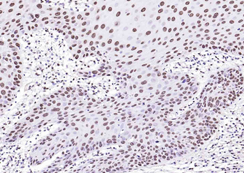 Histone H3 (di methyl K79) Mouse Monoclonal Antibody