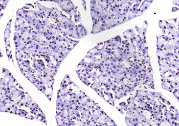 Histone H3 (di methyl K79) Mouse Monoclonal Antibody