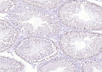 P53 (Mono Methyl Lys370) Mouse Monoclonal Antibody