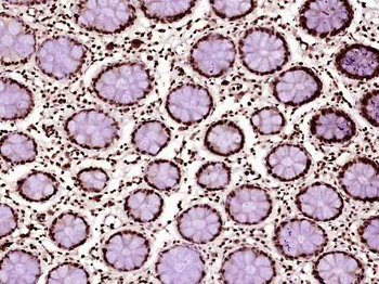 P53 (Mono Methyl Lys370) Mouse Monoclonal Antibody