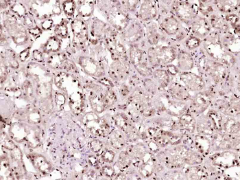 P53 (Mono Methyl Lys370) Mouse Monoclonal Antibody
