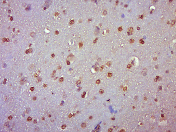 FOXO1 Rabbit Polyclonal Antibody