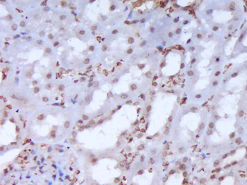 ROR gamma T Rabbit Polyclonal Antibody
