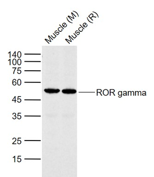 ROR gamma T Rabbit Polyclonal Antibody