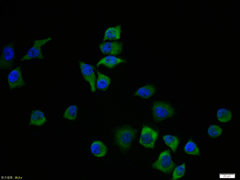 TERT Rabbit Polyclonal Antibody