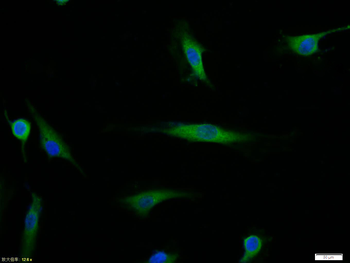 TERT Rabbit Polyclonal Antibody