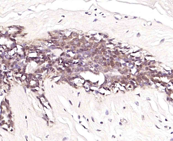 NUCB2 Rabbit Polyclonal Antibody