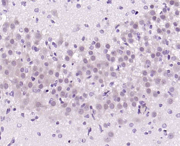 NUCB2 Rabbit Polyclonal Antibody